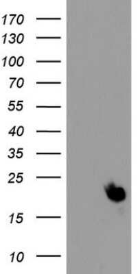 Western Blot: PPIH Antibody (OTI1C6) - Azide and BSA Free [NBP2-73572] - Analysis of HEK293T cells were transfected with the pCMV6-ENTRY control (Left lane) or pCMV6-ENTRY PPIH.