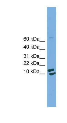 Western Blot: PPIH Antibody [NBP1-55448] - HepG2 cell lysate, concentration 0.2-1 ug/ml.
