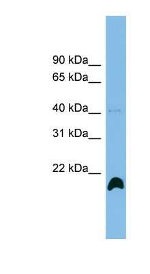 Western Blot: PPIH Antibody [NBP1-57630] - THP-1 cell lysate, concentration 0.2-1 ug/ml.