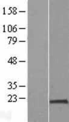 Western Blot: PPIH Overexpression Lysate (Adult Normal) [NBL1-14650] Left-Empty vector transfected control cell lysate (HEK293 cell lysate); Right -Over-expression Lysate for PPIH.