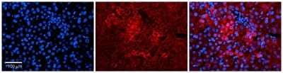 Immunohistochemistry: PPIL2 Antibody [NBP1-54366] - Formalin Fixed Paraffin Embedded Tissue: Human Liver Tissue Observed Staining: Cytoplasm in hepatocytes Primary Antibody Concentration: N/A Other Working Concentrations: 1:600 Secondary Antibody: Donkey anti-Rabbit-Cy3 Secondary Antibody Concentration: 1:200 Magnification: 20X Exposure Time: 0.5 - 2.0 sec