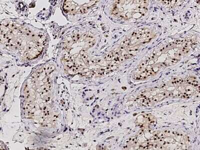 Immunohistochemistry-Paraffin: PPIL2 Antibody [NBP3-00291] - Immunochemical staining of human PPIL2 in human liver with rabbit polyclonal antibody (1:2000, formalin-fixed paraffin embedded sections).