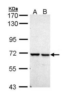 Western Blot: PPIL2 Antibody [NBP1-32933] - Sample (30 ug of whole cell lysate) A: 293T B: A431 7.5% SDS PAGE; antibody diluted at 1:10000.