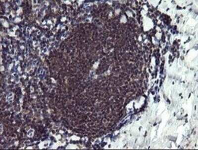 Immunohistochemistry: PPIL3 Antibody (OTI2E7) - Azide and BSA Free [NBP2-73574] - Analysis of Human tonsil tissue.