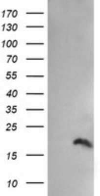 Western Blot: PPIL3 Antibody (OTI2E7) - Azide and BSA Free [NBP2-73574] - Analysis of HEK293T cells were transfected with the pCMV6-ENTRY control (Left lane) or pCMV6-ENTRY PPIL3.