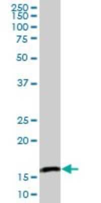 Western Blot: PPIL3 Antibody [H00053938-B01P] - Analysis of PPIL3 expression in human liver.