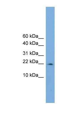 Western Blot: PPIL3 Antibody [NBP1-53189] - COLO205 cells lysate, concentration 0.2-1 ug/ml.