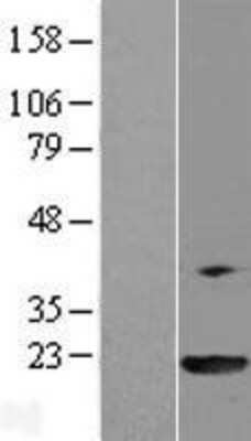 Western Blot: PPIL3 Overexpression Lysate (Adult Normal) [NBP2-09963] Left-Empty vector transfected control cell lysate (HEK293 cell lysate); Right -Over-expression Lysate for PPIL3.