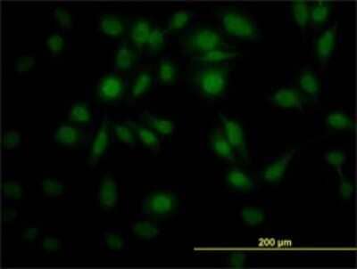 Immunocytochemistry/Immunofluorescence: PPIL4 Antibody (1C10) [H00085313-M01] - Analysis of monoclonal antibody to PPIL4 on HeLa cell. Antibody concentration 10 ug/ml.