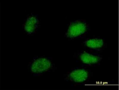 Immunocytochemistry/Immunofluorescence: PPIL4 Antibody [H00085313-B01P] - Analysis of purified antibody to PPIL4 on HeLa cell. (antibody concentration 10 ug/ml)