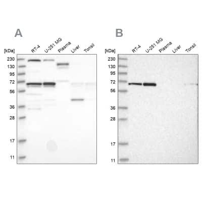 Western Blot: PPIL4 Antibody [NBP2-55080] - Analysis using Anti-PPIL4 antibody NBP2-55080 (A) shows similar pattern to independent antibody NBP1-85921 (B).