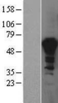 Western Blot: PPIL4 Overexpression Lysate (Adult Normal) [NBP2-04420] Left-Empty vector transfected control cell lysate (HEK293 cell lysate); Right -Over-expression Lysate for PPIL4.