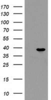 Western Blot: PPIL6 Antibody (4F2) [NBP2-03728] - HEK293T cells were transfected with the pCMV6-ENTRY control (Left lane) or pCMV6-ENTRY PPIL6 (Right lane) cDNA for 48 hrs and lysed. Equivalent amounts of cell lysates (5 ug per lane) were separated by SDS-PAGE and immunoblotted with anti-PPIL6.