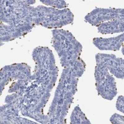 Immunohistochemistry-Paraffin: PPIL6 Antibody [NBP3-17419] - Staining of human fallopian tube shows strong membraneous positivity in glandular cells.