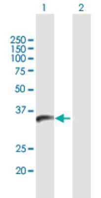 Western Blot: PPIL6 Antibody [H00285755-B01P] - Analysis of PPIL6 expression in transfected 293T cell line by PPIL6 polyclonal antibody.  Lane 1: PPIL6 transfected lysate(34.21 KDa). Lane 2: Non-transfected lysate.