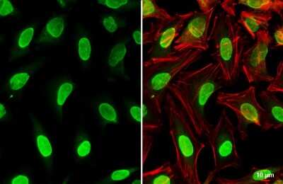 Immunocytochemistry/Immunofluorescence: PPM1D Antibody [NBP3-12941] - PPM1D antibody detects PPM1D protein at nucleus by immunofluorescent analysis. Sample: HeLa cells were fixed in 4% paraformaldehyde at RT for 15 min. Green: PPM1D stained by PPM1D antibody (NBP3-12941) diluted at 1:500. Red: phalloidin, a cytoskeleton marker, diluted at 1:100. Scale bar= 10 um.