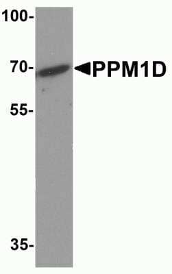 Western Blot: PPM1D Antibody [NBP2-81881] - Analysis of PPM1D in 3T3 cell lysate with PPM1D antibody at 1 ug/ml.