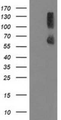 Western Blot: PPM1G Antibody (1C12) [NBP2-03463] - HEK293T cells were transfected with the pCMV6-ENTRY control (Left lane) or pCMV6-ENTRY PPM1G (Right lane) cDNA for 48 hrs and lysed. Equivalent amounts of cell lysates (5 ug per lane) were separated by SDS-PAGE and immunoblotted with anti-PPM1G.