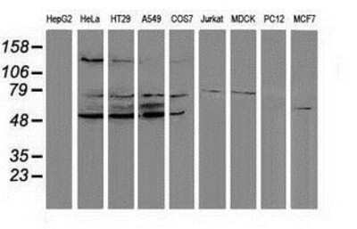 Western Blot: PPM1G Antibody (1C12) [NBP2-03463] Analysis of extracts (35ug) from 9 different cell lines by using anti-PPM1G monoclonal antibody (HepG2: human; HeLa: human; SVT2: mouse; A549: human; COS7: monkey; Jurkat: human; MDCK: canine; PC12: rat; MCF7: human).