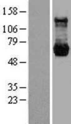 Western Blot: PPM1G Overexpression Lysate (Adult Normal) [NBL1-14662] Left-Empty vector transfected control cell lysate (HEK293 cell lysate); Right -Over-expression Lysate for PPM1G.