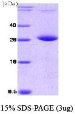 SDS-Page: PPM1G Protein [NBC1-18399] - PPM1G, 27 kDa (250 aa), confirmed by MALDI-TOF with a purity of 95% by SDS - PAGE
