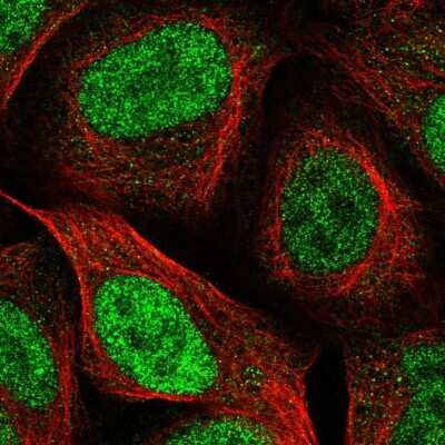 Immunocytochemistry/ Immunofluorescence PPM1H Antibody - BSA Free