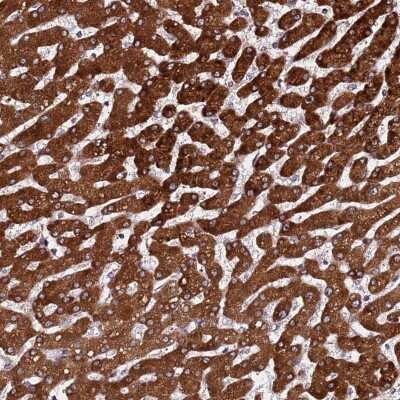 Immunohistochemistry PPM1H Antibody - BSA Free