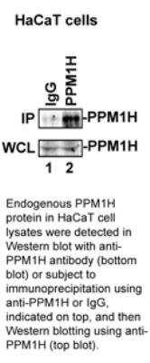 Western Blot: PPM1H Antibody [30170002] - (antibody dilution 1:1000) Image courtesy of a SDI customer