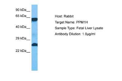 Western Blot PPM1H Antibody - BSA Free