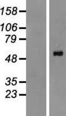Western Blot PPM1H Overexpression Lysate