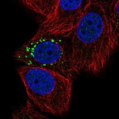 Immunocytochemistry/ Immunofluorescence PPM1J Antibody - BSA Free
