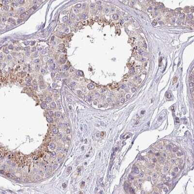 Immunohistochemistry-Paraffin PPM1J Antibody - BSA Free