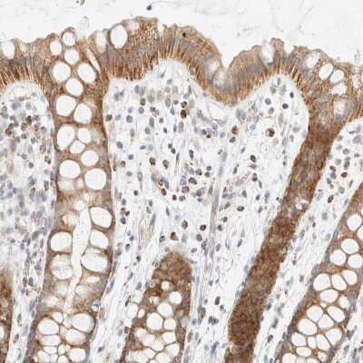 Immunohistochemistry-Paraffin: PPM1K Antibody [NBP1-85036] - Staining of human rectum shows cytoplasmic positivity in glandular cells.
