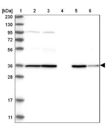 Western Blot: PPM1K Antibody [NBP1-85036] - Lane 1: Marker  [kDa] 230, 130, 95, 72, 56, 36, 28, 17, 11.  Lane 2: Human cell line RT-4.  Lane 3: Human cell line U-251MG sp.  Lane 4: Human plasma (IgG/HSA depleted).  Lane 5: Human liver tissue.  Lane 6: Human tonsil tissue
