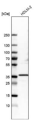 Western Blot: PPM1K Antibody [NBP1-85036] - Analysis in human cell line HDLM-2.
