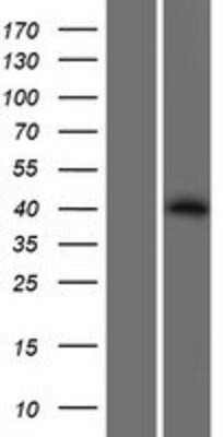 Western Blot: PPM1L Overexpression Lysate (Adult Normal) [NBL1-14666] Left-Empty vector transfected control cell lysate (HEK293 cell lysate); Right -Over-expression Lysate for PPM1L.