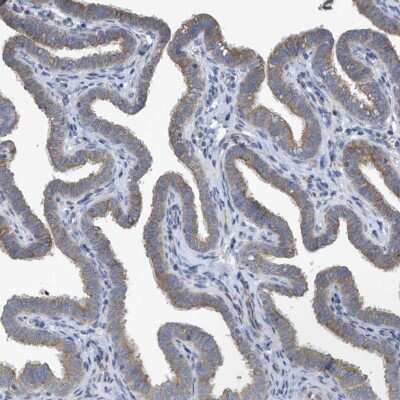Immunohistochemistry-Paraffin: PPM1M Antibody [NBP1-83534] - Staining of human fallopian tube shows cytoplasmic positivity in glandular cells.