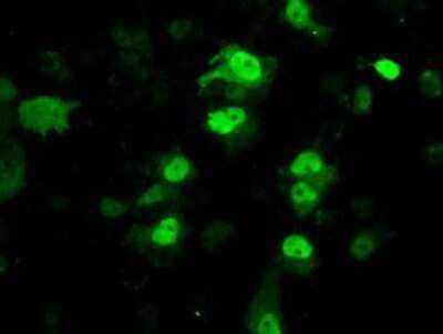 Immunocytochemistry/Immunofluorescence: PPME1 Antibody (7F12) [NBP2-02240] Staining of COS7 cells transiently transfected by pCMV6-ENTRY PPME1.