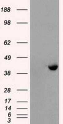 Western Blot PPME1 Antibody (OTI7F12)