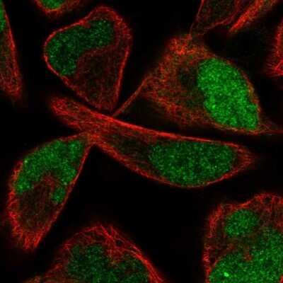 Immunocytochemistry/Immunofluorescence: PPME1 Antibody [NBP2-57103] - Staining of human cell line RH-30 shows localization to nucleoplasm.