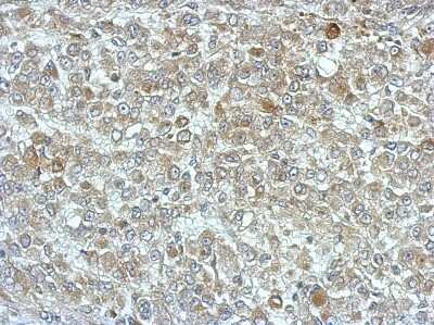 Immunohistochemistry-Paraffin: PPME1 Antibody [NBP2-19904] - Immunohistochemical analysis of paraffin-embedded Hela xenograft, using antibody at 1:500 dilution.