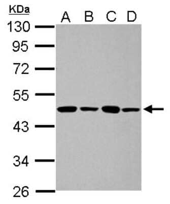 Western Blot: PPME1 Antibody [NBP2-19903] - Sample (30 ug of whole cell lysate) A: 293T B: A431 C: HeLa D: HepG2 10% SDS PAGE gel, diluted at 1:1000.