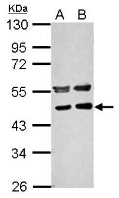Western Blot PPME1 Antibody - BSA Free