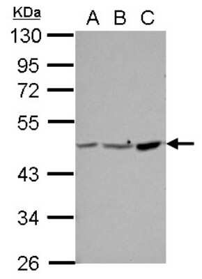 Western Blot: PPME1 Antibody [NBP2-19904] - Sample (30 ug of whole cell lysate) A: 293T B: A431 C: HeLa 10% SDS PAGE gel, diluted at 1:10000.