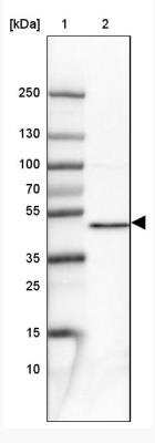 Western Blot PPME1 Antibody - BSA Free