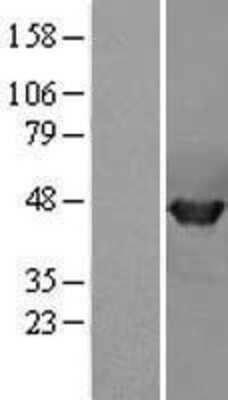 Western Blot: PPME1 Overexpression Lysate (Adult Normal) [NBL1-14668] Left-Empty vector transfected control cell lysate (HEK293 cell lysate); Right -Over-expression Lysate for PPME1.