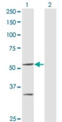 Western Blot: PPOX Antibody (2B5) [H00005498-M04] - Analysis of PPOX expression in transfected 293T cell line by PPOX monoclonal antibody (M04), clone 2B5. Lane 1: PPOX transfected lysate (Predicted MW: 50.8 KDa). Lane 2: Non-transfected lysate.