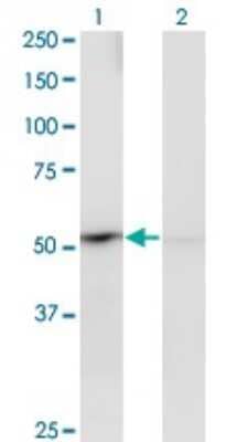 Western Blot: PPOX Antibody (2C10) [H00005498-M02] - Analysis of PPOX expression in transfected 293T cell line by PPOX monoclonal antibody (M02), clone 2C10.Lane 1: PPOX transfected lysate (Predicted MW: 50.8 KDa).Lane 2: Non-transfected lysate.