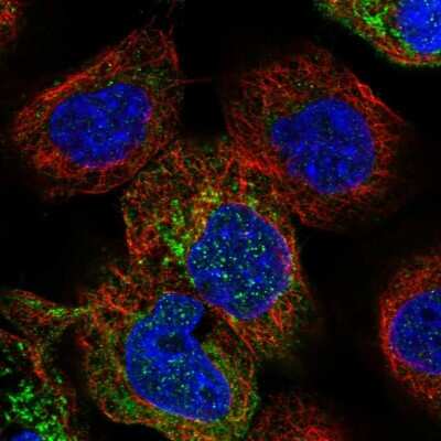 Immunocytochemistry/Immunofluorescence: PPOX Antibody [NBP1-80885] - Immunofluorescent staining of human cell line A-431 shows localization to cytosol & mitochondria.