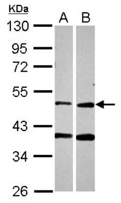 Western Blot: PPOX Antibody [NBP2-19905] - Sample (30 ug of whole cell lysate) A: A549 B: HCT116 10% SDS PAGE gel, diluted at 1:2000.